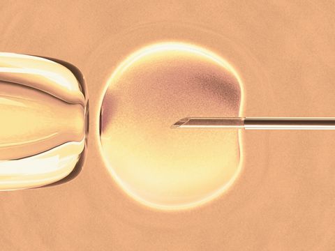 artwork of in vitro fertilization