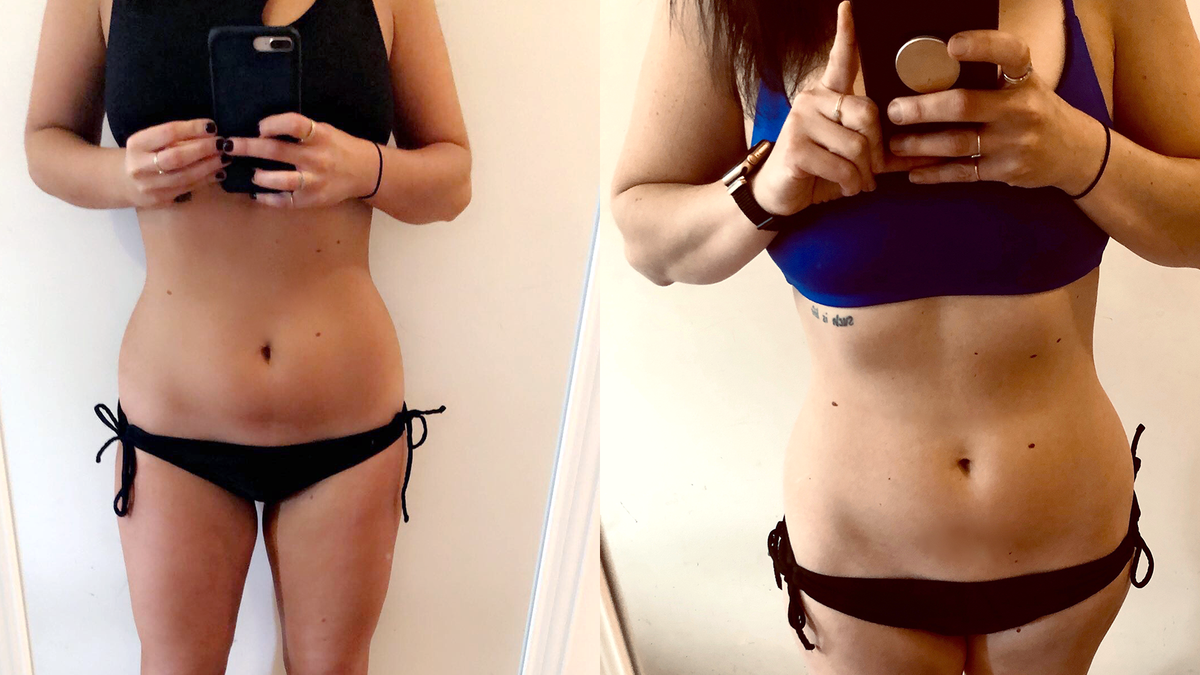 Sculpt Body Clinics is all about RESULTS! When body sculpting