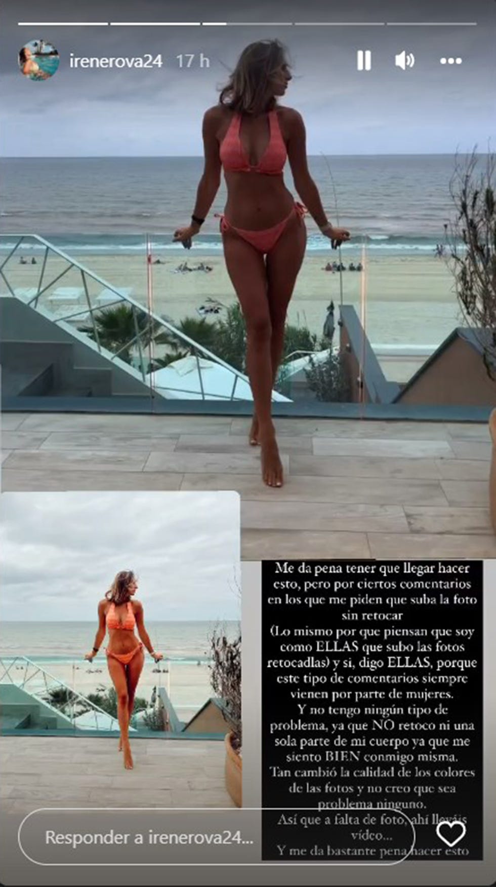 irene rosales habla de sus retoques en las fotos