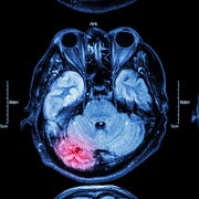brain mri brain mri