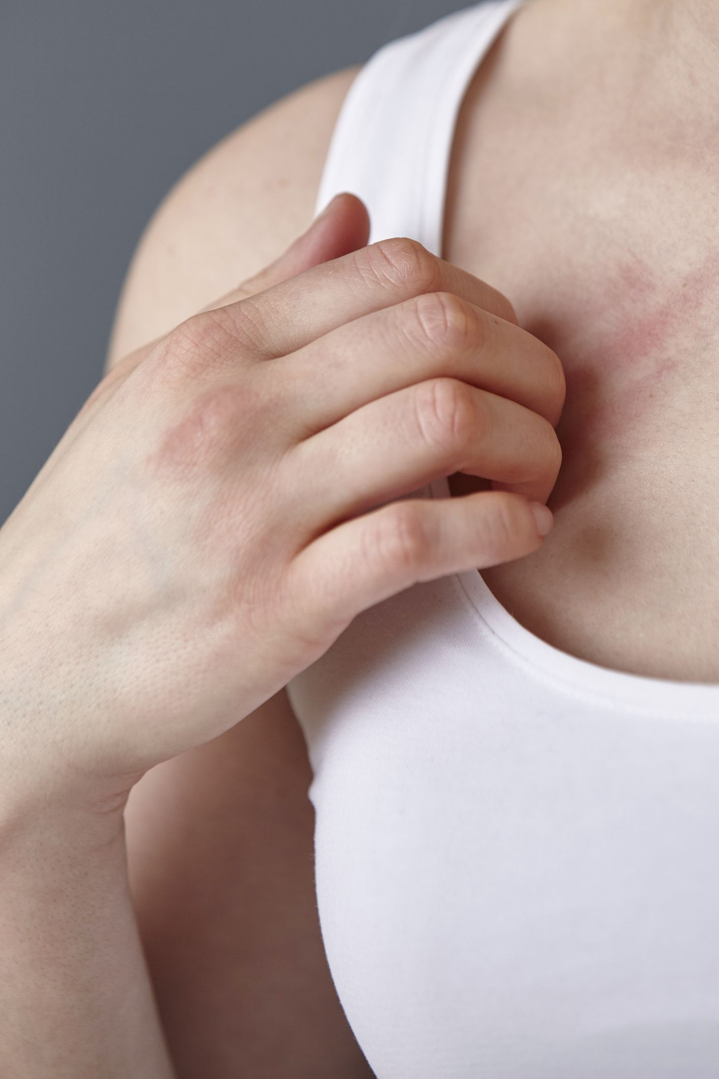 Breast Itch - Symptoms, Causes, Treatments