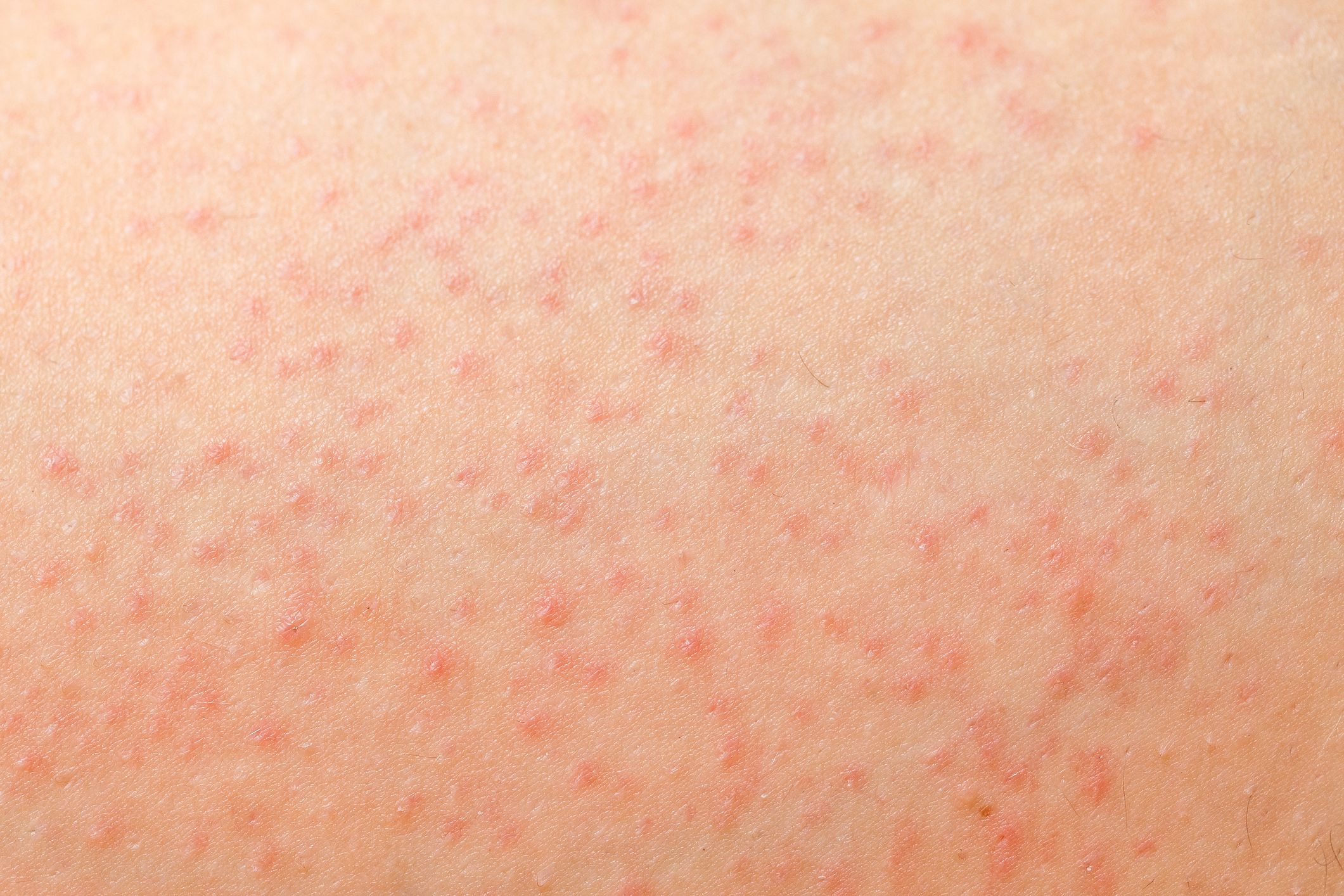 8 Common Causes of Itchy Bumps and Lumps Around Your Vagina