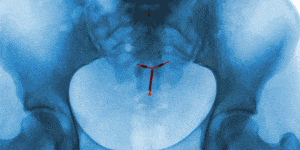 Neck, Organ, Joint, Jaw, Mouth, Tooth, X-ray, Illustration, 
