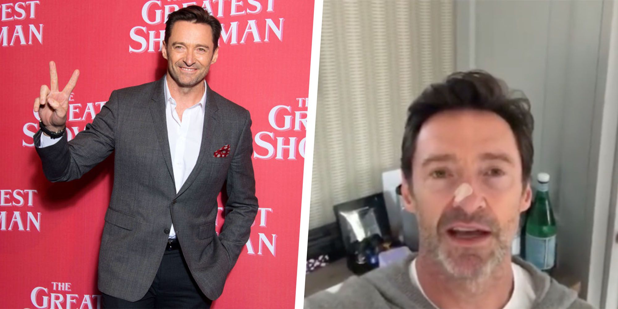 Hugh Jackman Continues His Personal Sunscreen PSA After Another