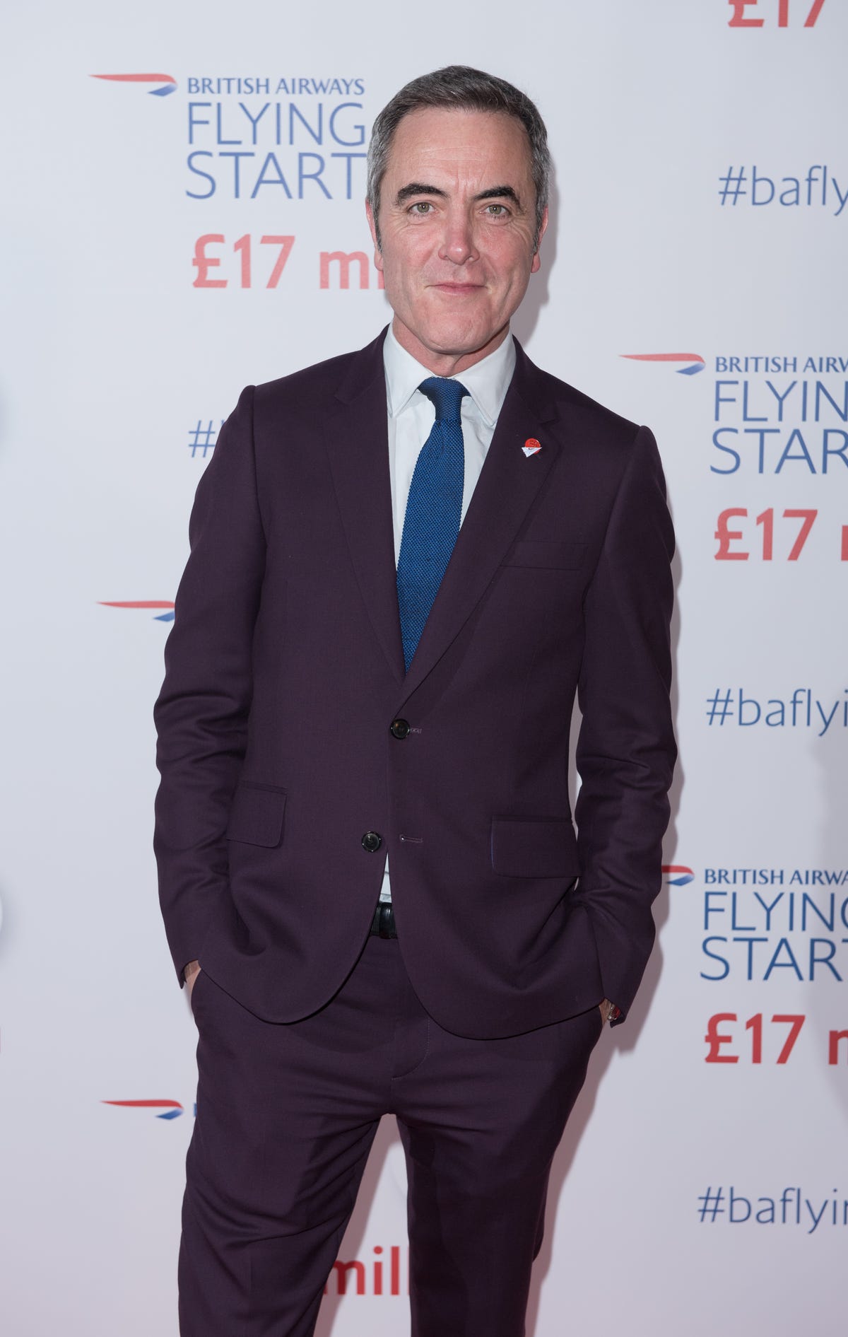 james nesbitt