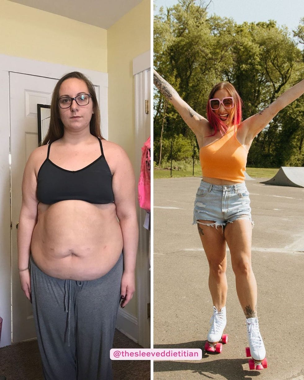 I'm A Dietitian—Here's How I Lost Weight On Mounjaro And Surgery'