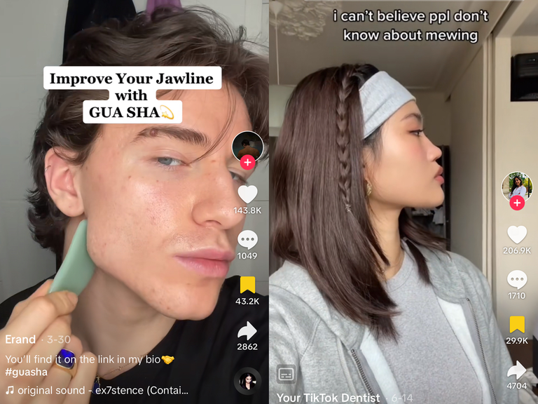 Can TikTok Tips Create a More Defined Jawline? Mewing Explained