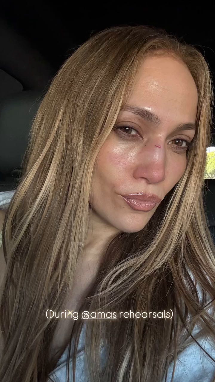 Jennifer Lopez accident