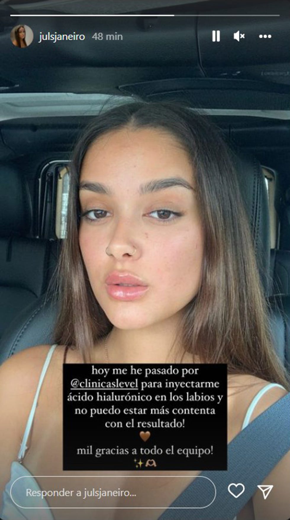 julia janeiro posa en instagram con sus nuevos labios tras su retoque estético