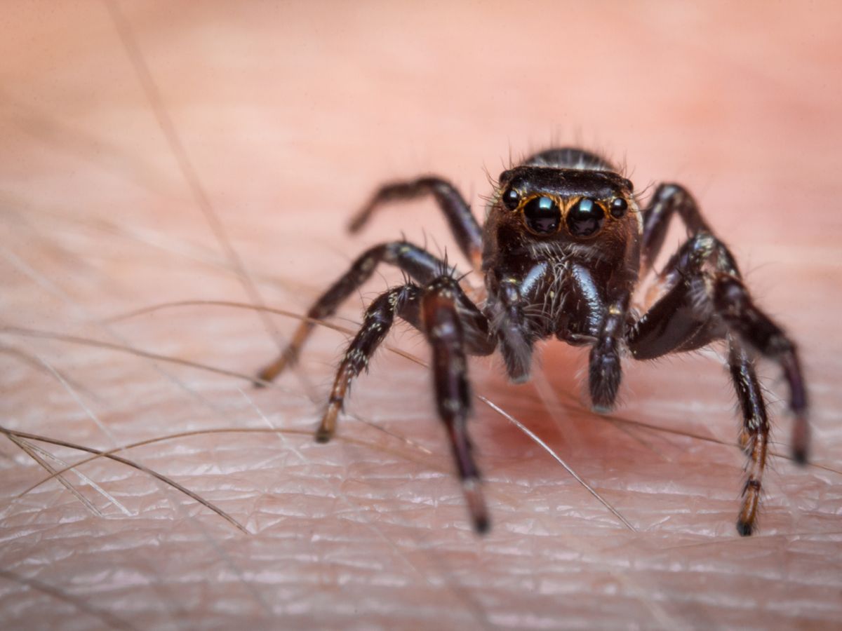 What to Do If You Have a Spider Bite - Sharecare