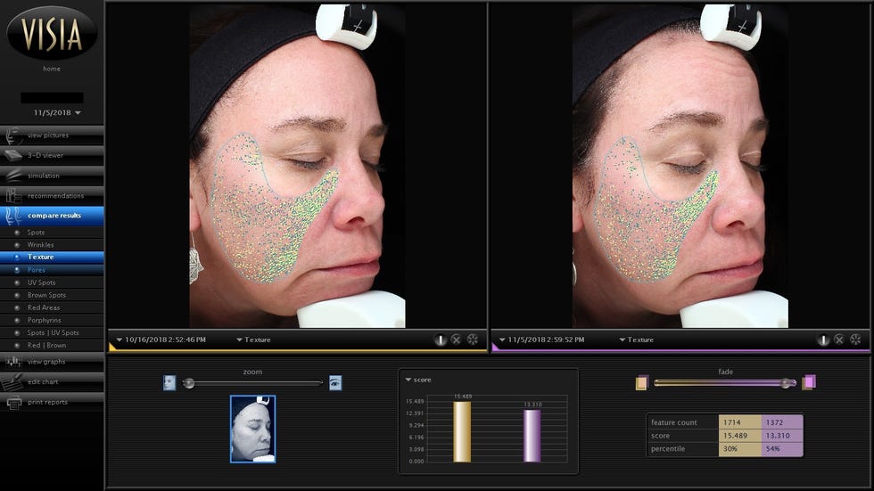 good housekeeping institute beauty lab face peel testing with the visia complexion analyzer