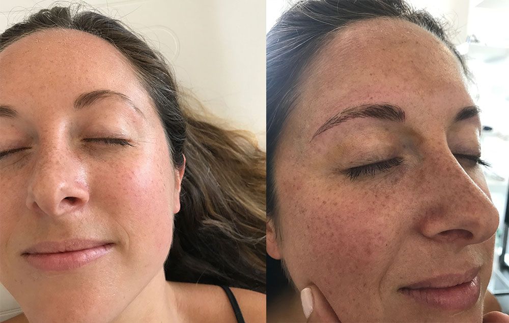 Kelli Accardio microblading before and after