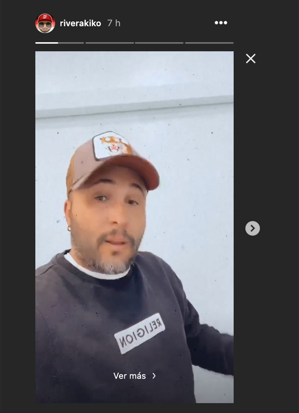 kiko rivera en un storie de instagram