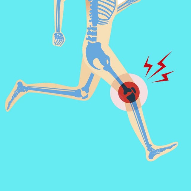runners knee recovery