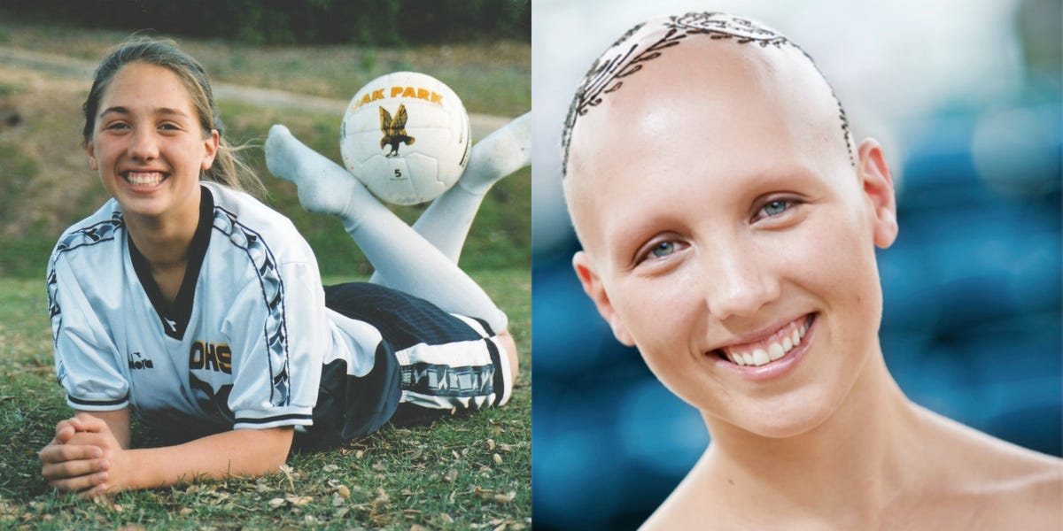 Sports Illustrated model with alopecia pulls off her wig on the runway