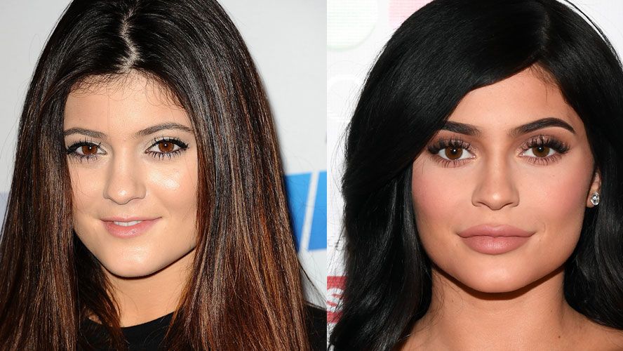 Kylie Jenner's doctor discusses her changing face