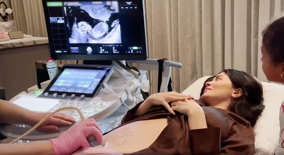 kylie jenner shows her ultrasound