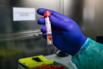 Swabs Are Tested For Coronavirus At Milan Laboratory