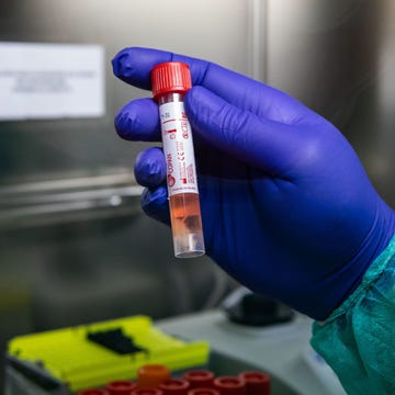 Swabs Are Tested For Coronavirus At Milan Laboratory Swabs Are Tested For Coronavirus At Milan Laboratory