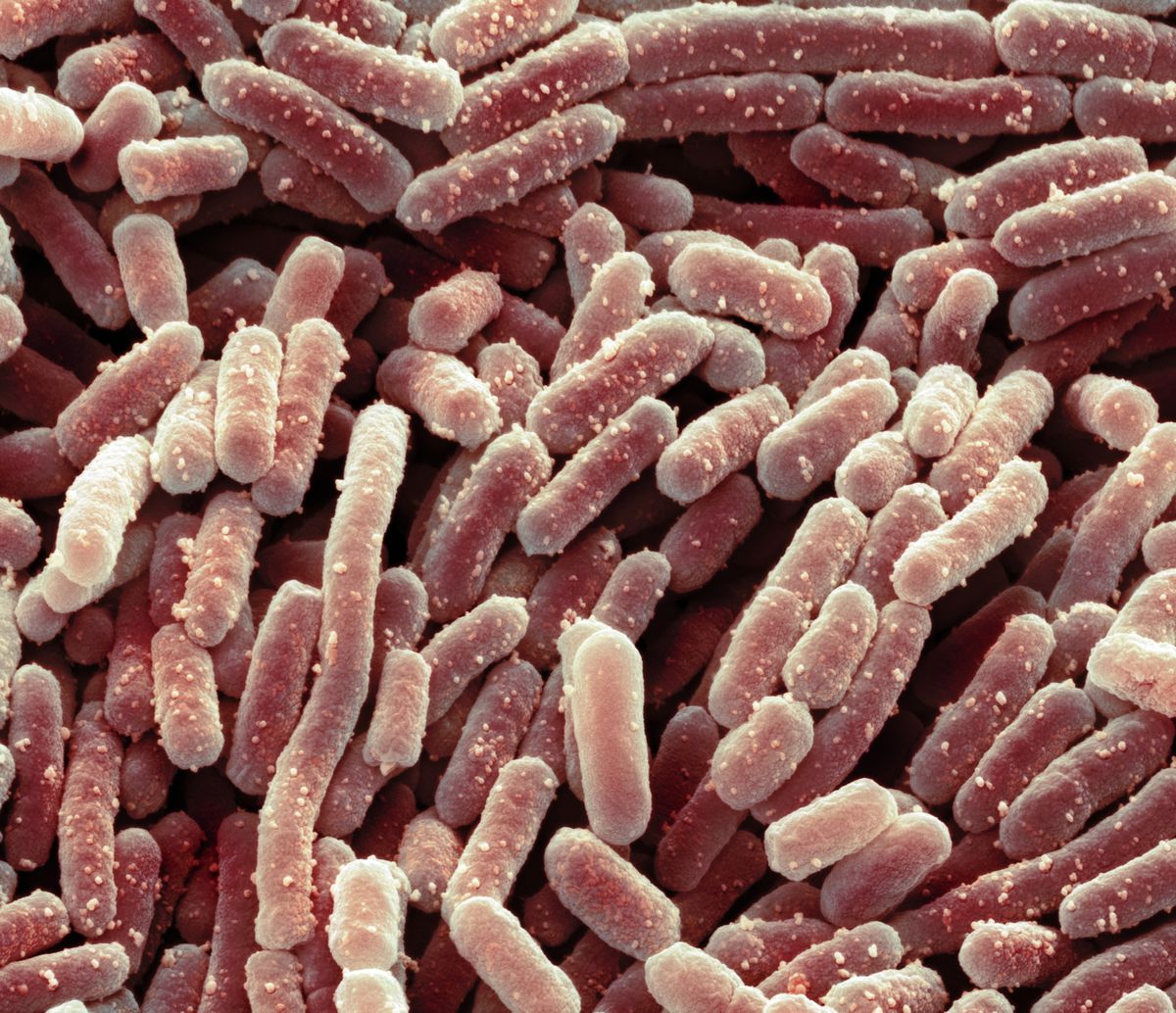 Lactobacillus bacteria, SEM