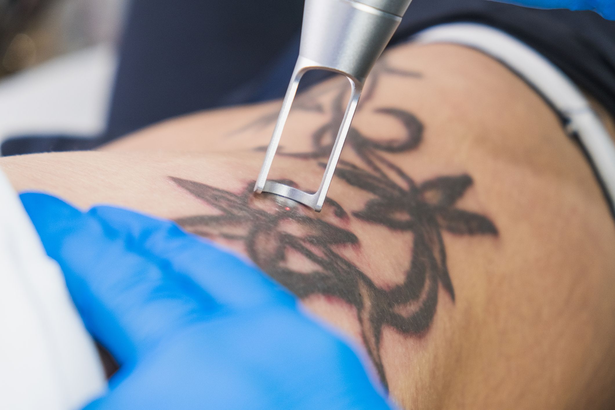 Why do some people feel unwell the day after long tattoo sessions  Quora