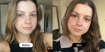 latisse reviews before and after