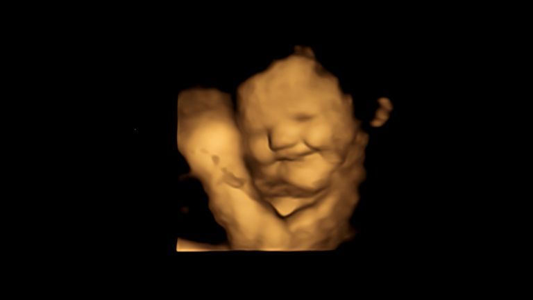 まだまだ明かされていないことが多い、妊娠・出産中の身体の不思議。「妊娠中は二人分食べる」という言葉があるけれど、その詳細が発表される日も近いかもしれません。今回は＜コスモポリタン　イギリス版＞より、胎児と母体に関する興味深い研究結果をご紹介。