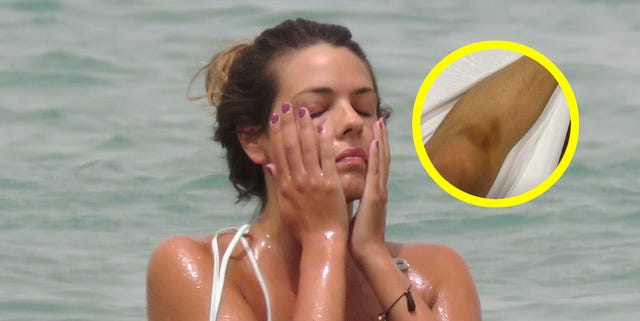 Laura Matamoros sufre un doloroso golpe que acaba en moretón en la rodilla laura matamoros sufre un doloroso golpe que acaba en moretón en la rodilla