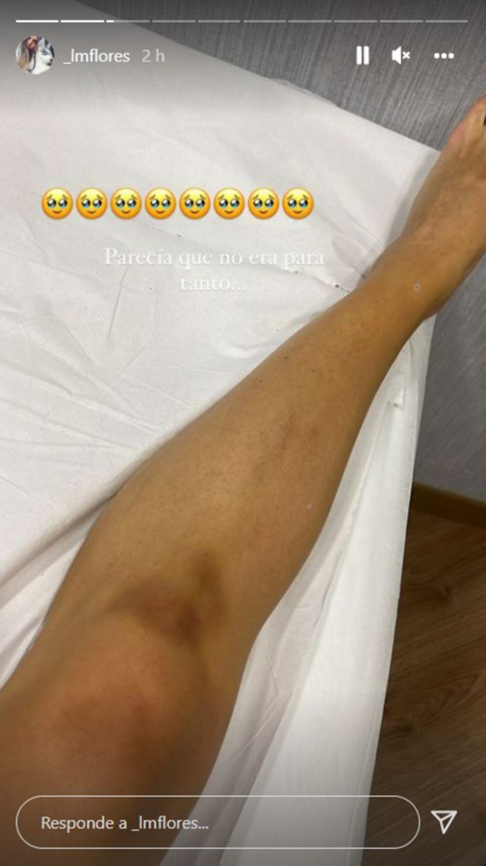 laura matamoros sufre un doloroso golpe que acaba en moretón en la rodilla