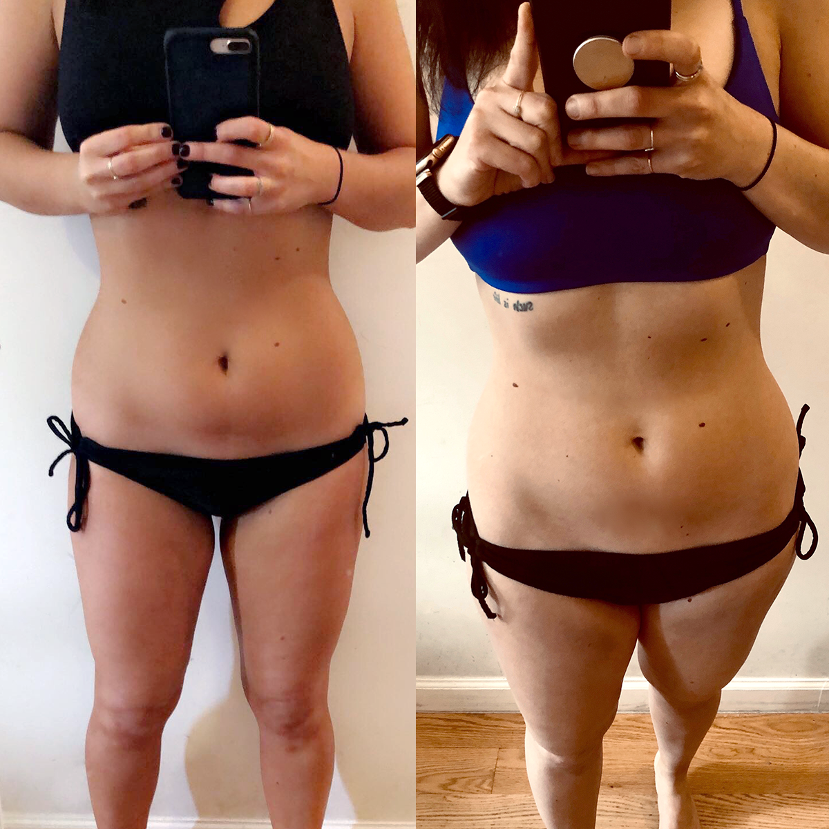 Emsculpt before and after review