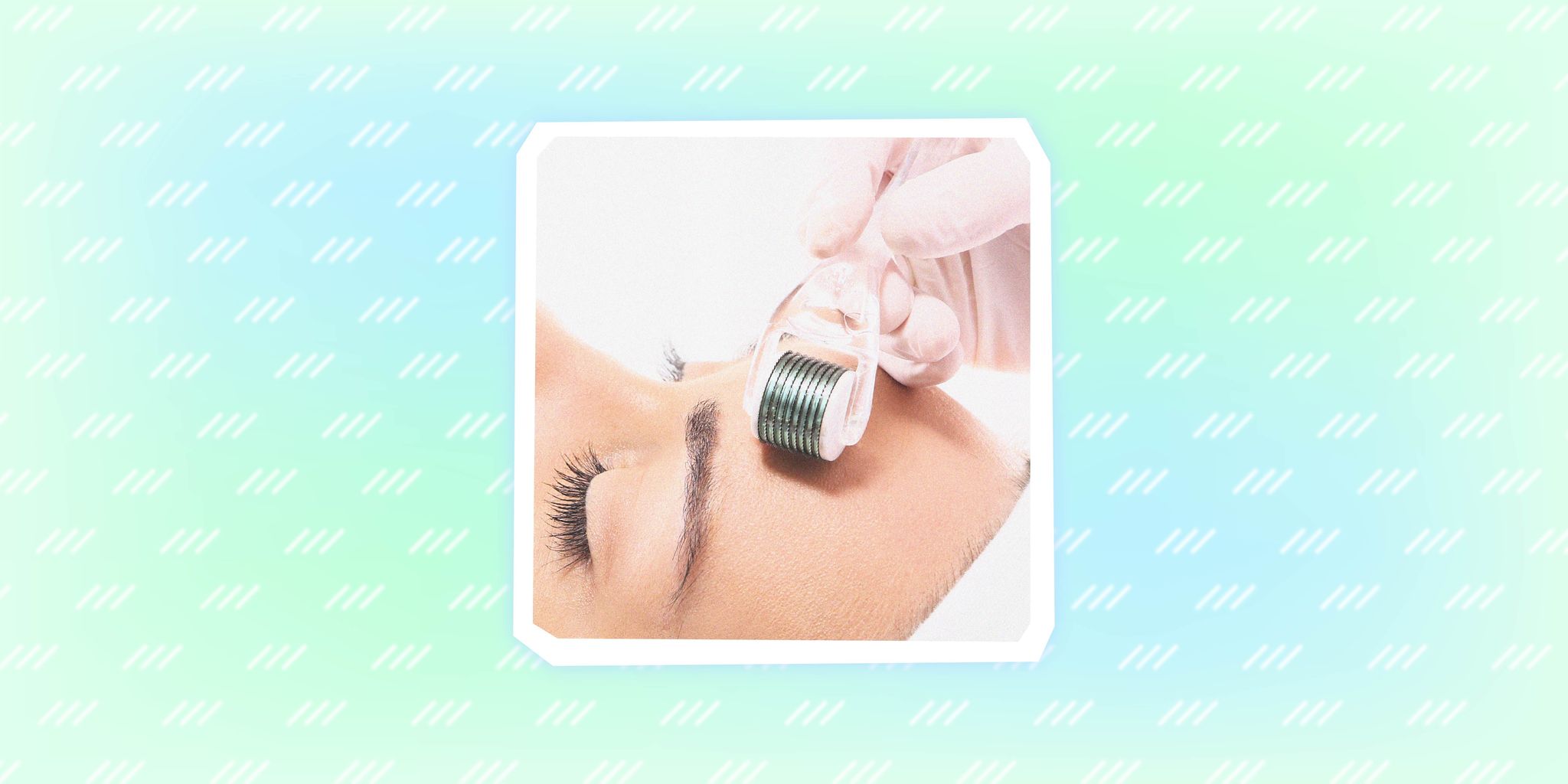 what is microneedling