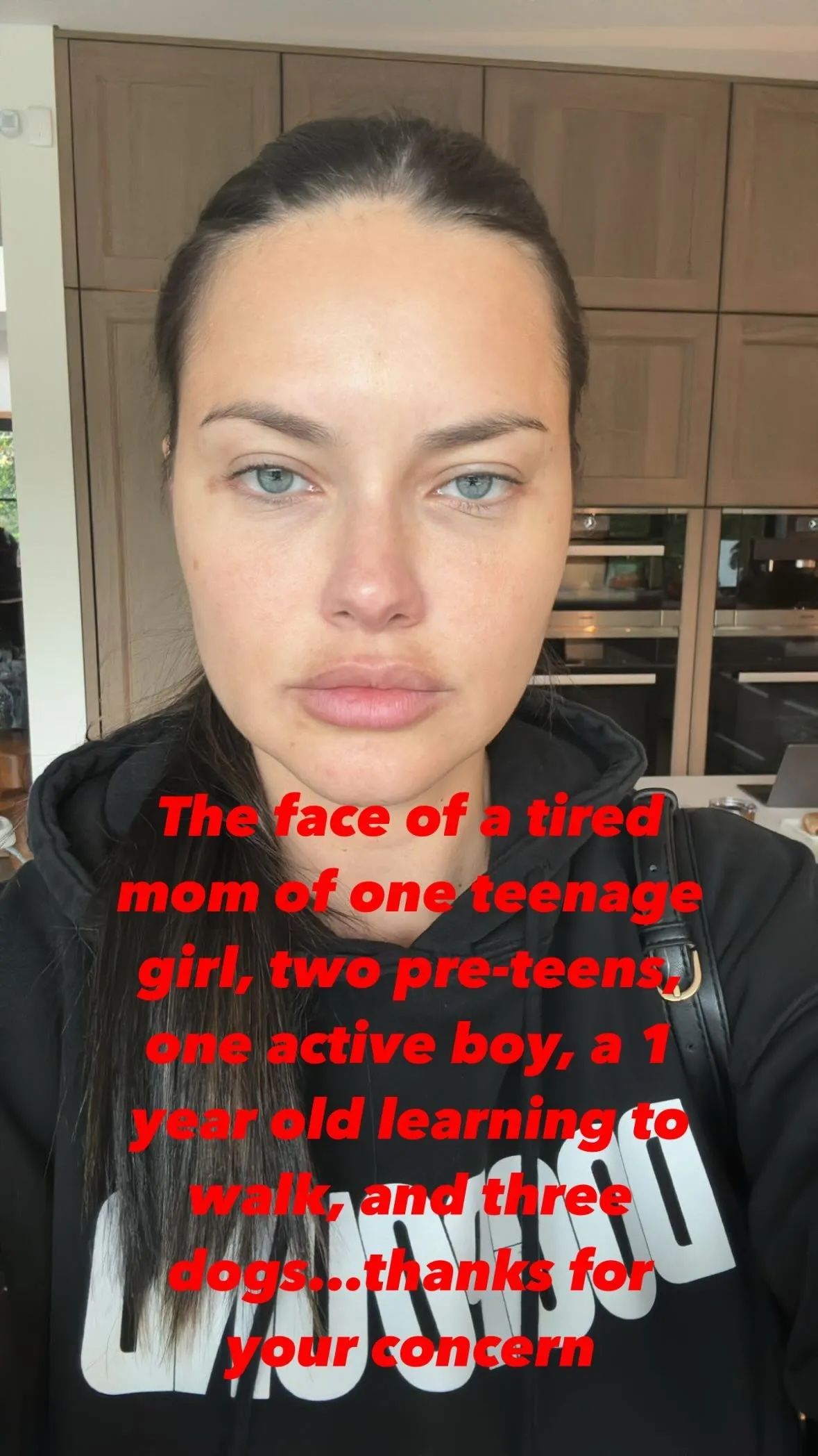 Adriana Lima claps back at followers who say she looks swollen