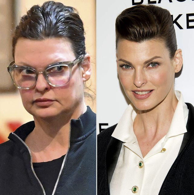 linda evangelista, antes y después de la operación estética que la desfiguró por completo