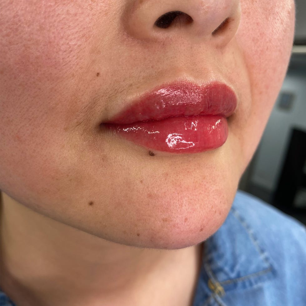 jamie ueda immediately after lip blushing