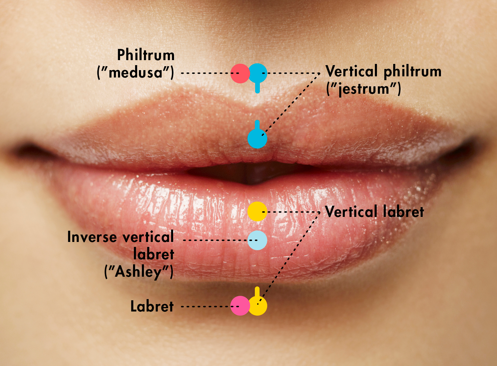 question for people with these lip piercings, have they damaged your teeth  or gums any? also would it be a bad idea with braces? : r/bodymods