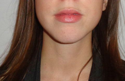 Peppermint oil lip plumper