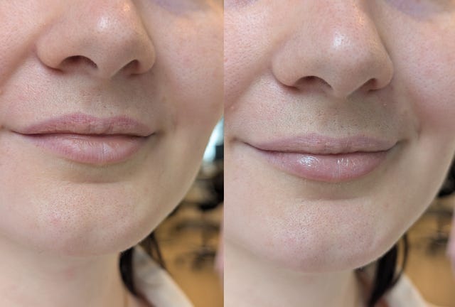best lip scrubs