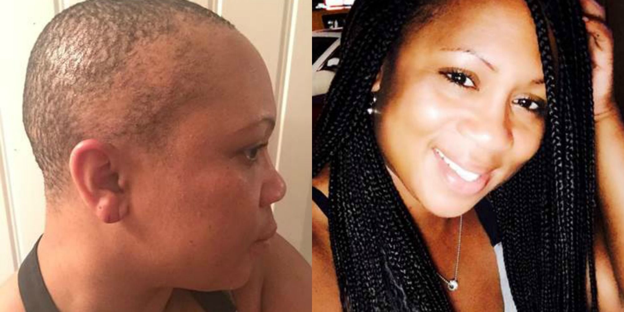 5 Ways You Can Re-grow Your Edges And Nape Hairs - Reina Haircare