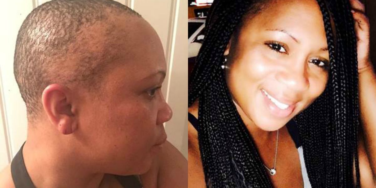 This Woman Turned Traction Alopecia Into a Lesson In Self-Care