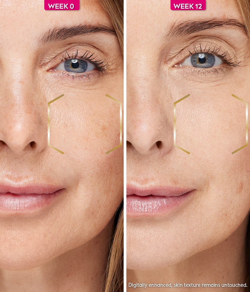 louise redknapp pigmentation serum