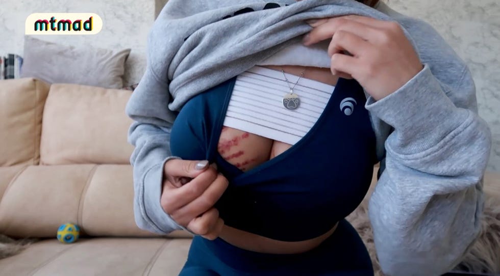lucia sánchez, preocupada tras su operación de pecho, enseña las marcas que se tiene que arreglar