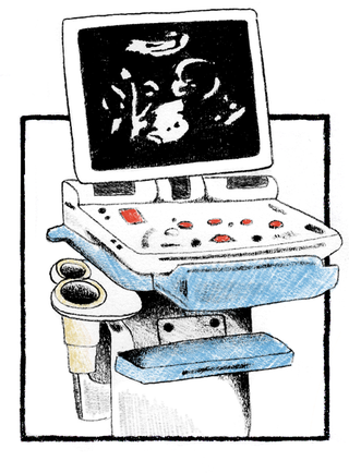 sonogram machine, illustrations by lia kantrowitz