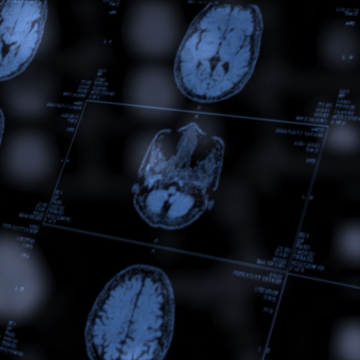 A Single Cubic Millimeter of Brain Tissue May Have Just Changed Neuroscience Forever