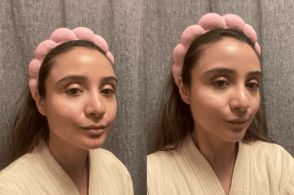 best foundations for acne — Make Up For Ever Matte Velvet Skin Full Coverage Foundation make up for ever matte velvet skin full coverage foundation