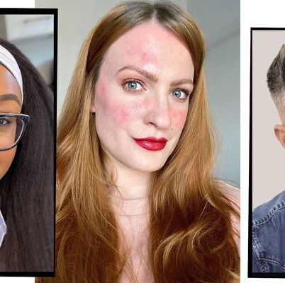 The Best Make-Up For Rosacea, According To The Experts