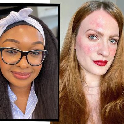 opladning forbandelse forbandelse The Best Make-Up For Rosacea, According To The Experts