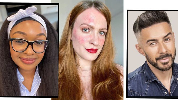 opladning forbandelse forbandelse The Best Make-Up For Rosacea, According To The Experts