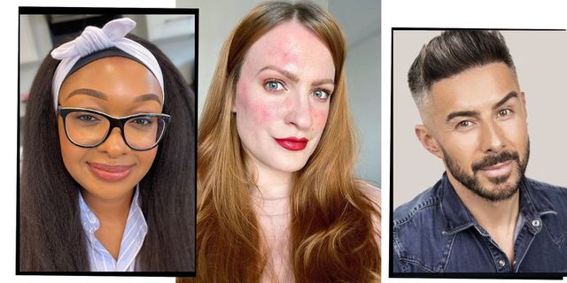 The Best Make-Up For Rosacea, According The Experts