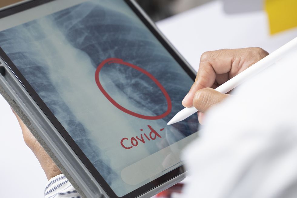 a male asian doctor is writing a x ray summary of coronavirus patients on a tablet at the hospital