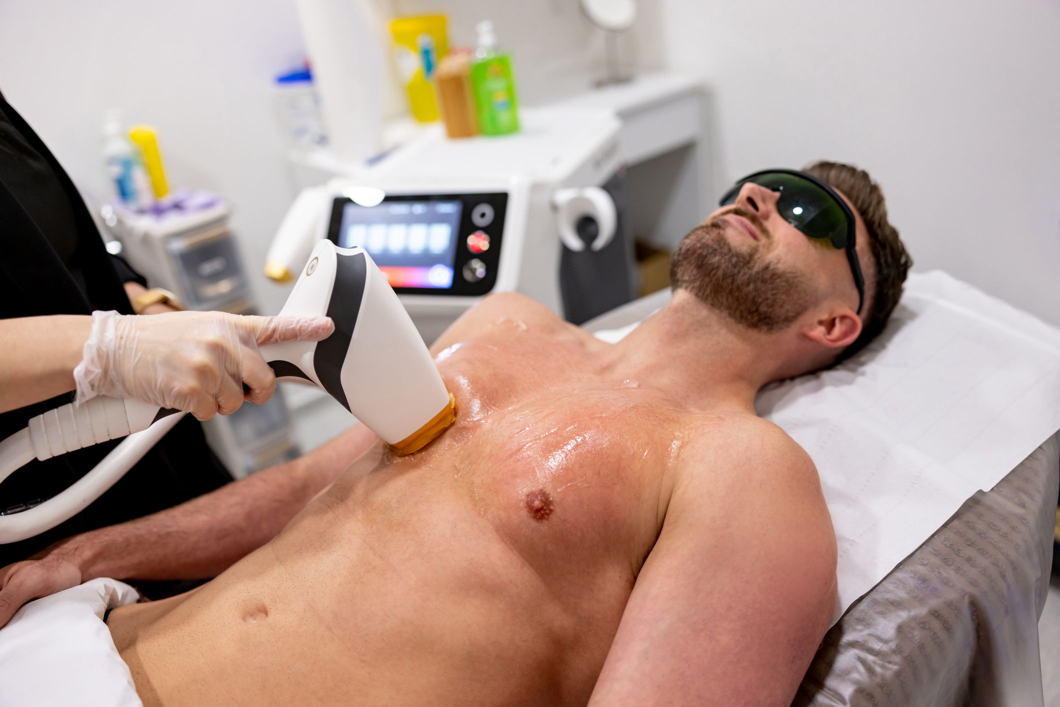 Laser Hair Removal Raleigh